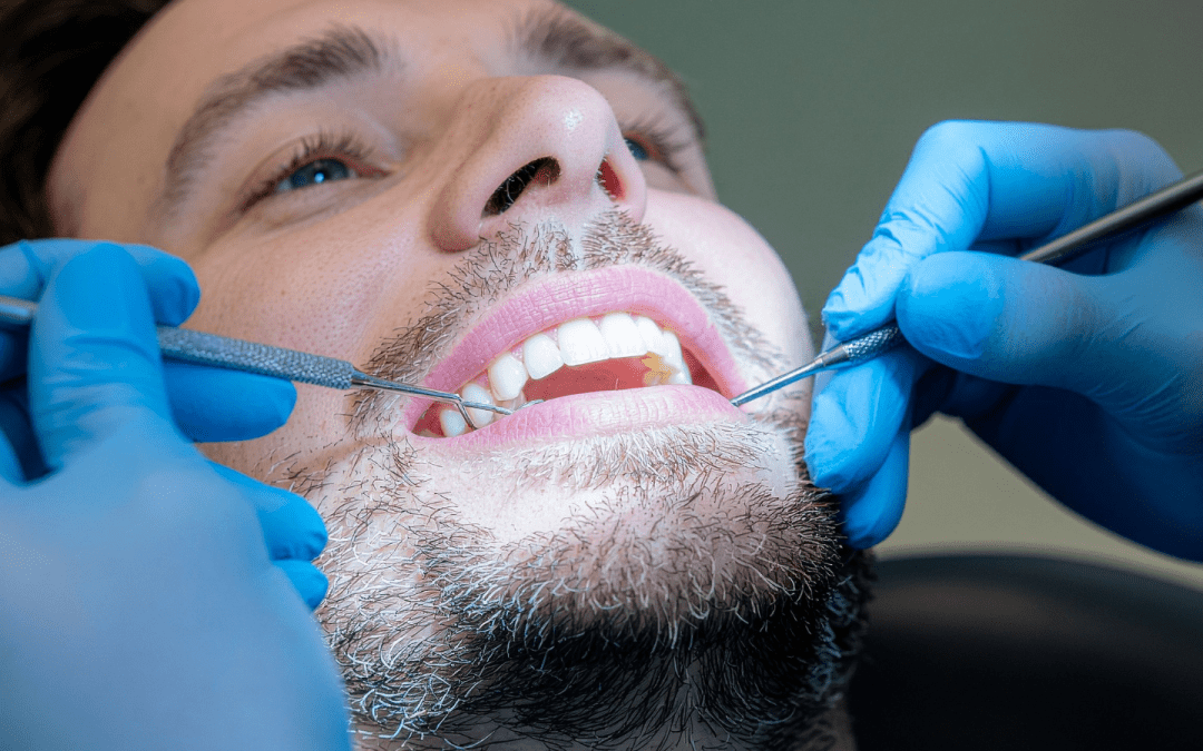 Why Professional Teeth Cleaning Is Your Smile’s Best Defense