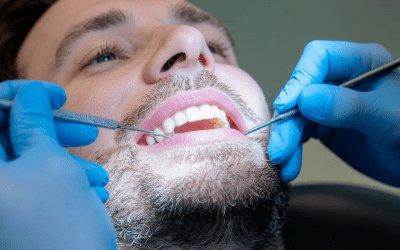 Could Your Dentist Be the First to Spot Your Sleep Apnea?
