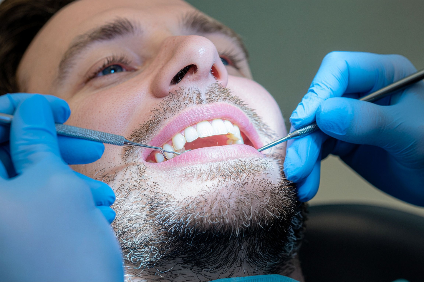 Professional Teeth Cleaning Is Essential for Oral Health