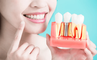 How Dental Implants Restore Confidence and Function