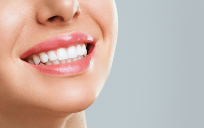 Veneers vs Teeth Whitening: Which One Is Right for Your Smile?